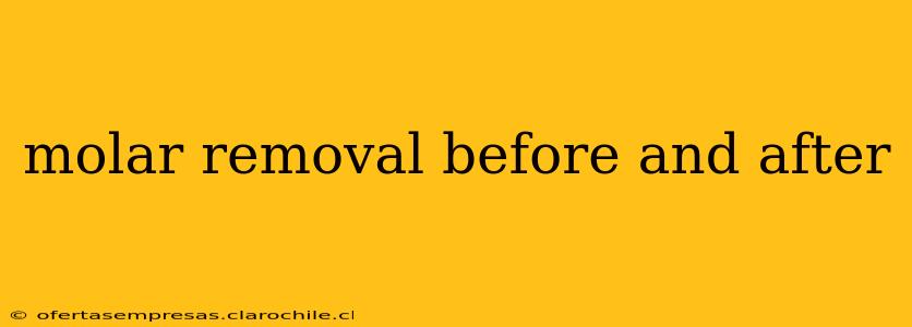 molar removal before and after