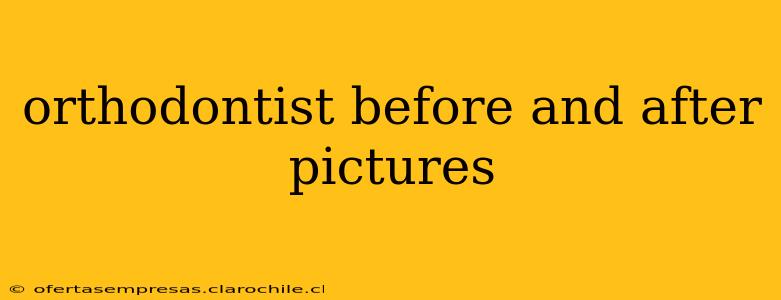 orthodontist before and after pictures