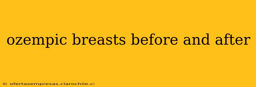 ozempic breasts before and after