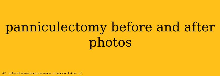 panniculectomy before and after photos