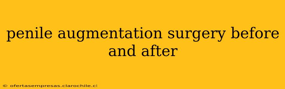 penile augmentation surgery before and after