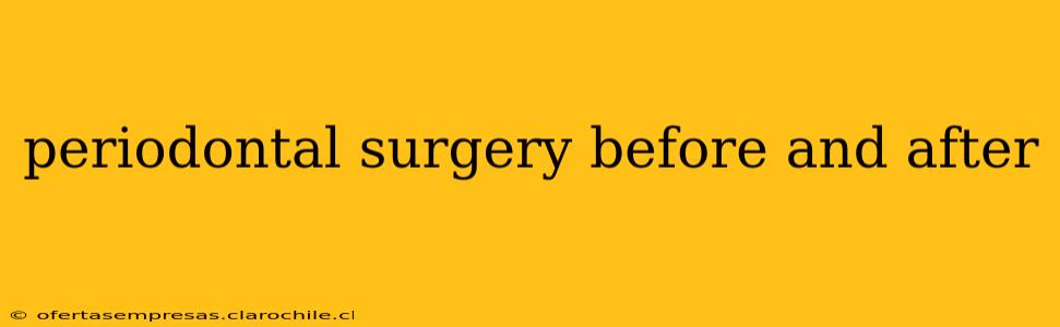 periodontal surgery before and after