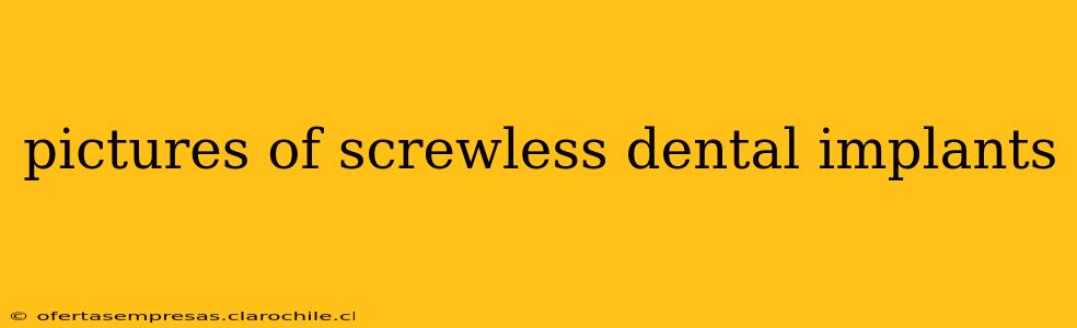 pictures of screwless dental implants