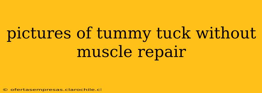 pictures of tummy tuck without muscle repair