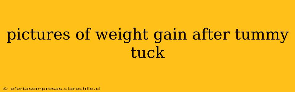 pictures of weight gain after tummy tuck