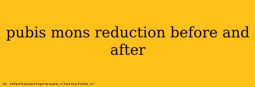pubis mons reduction before and after