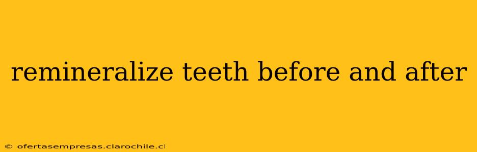 remineralize teeth before and after