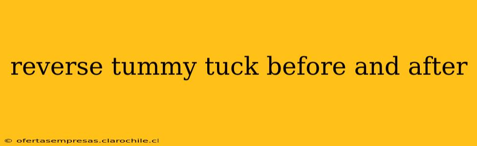 reverse tummy tuck before and after