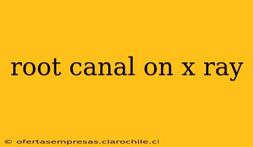 root canal on x ray