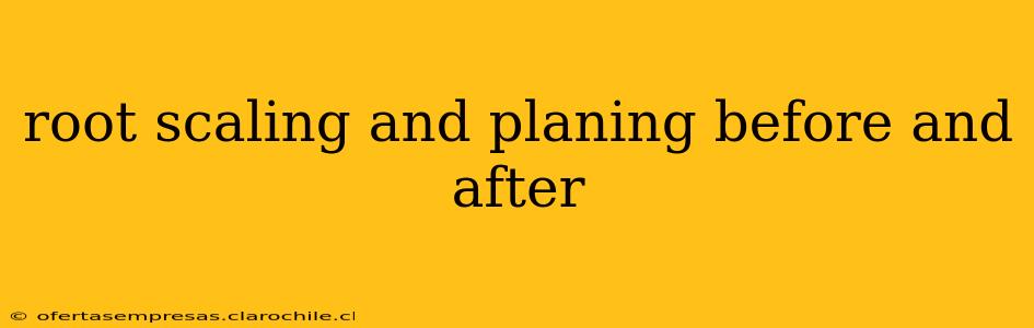 root scaling and planing before and after