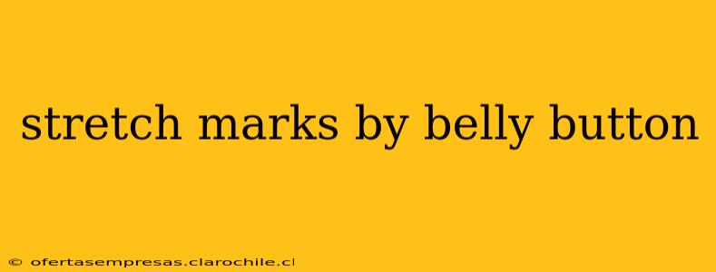 stretch marks by belly button