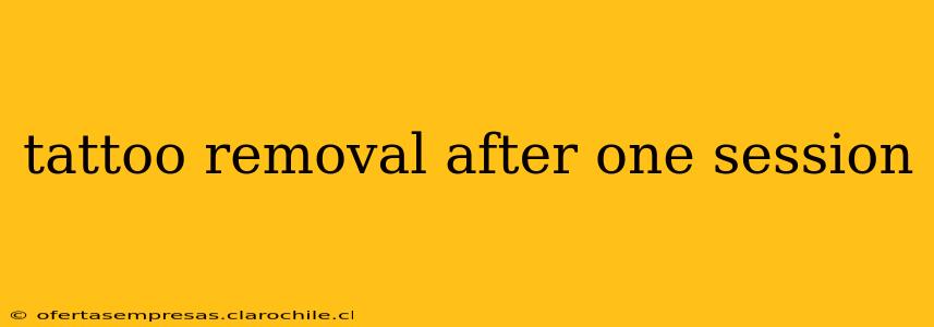 tattoo removal after one session
