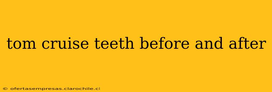 tom cruise teeth before and after