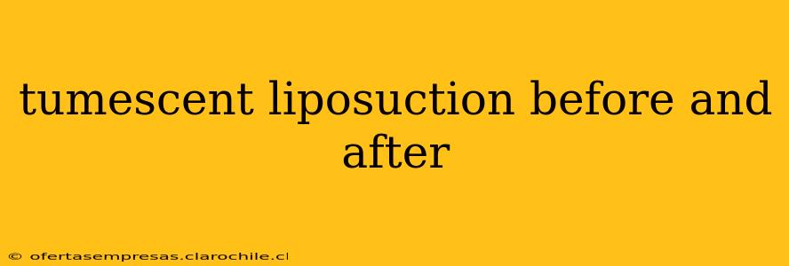 tumescent liposuction before and after
