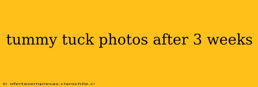 tummy tuck photos after 3 weeks