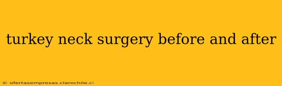 turkey neck surgery before and after