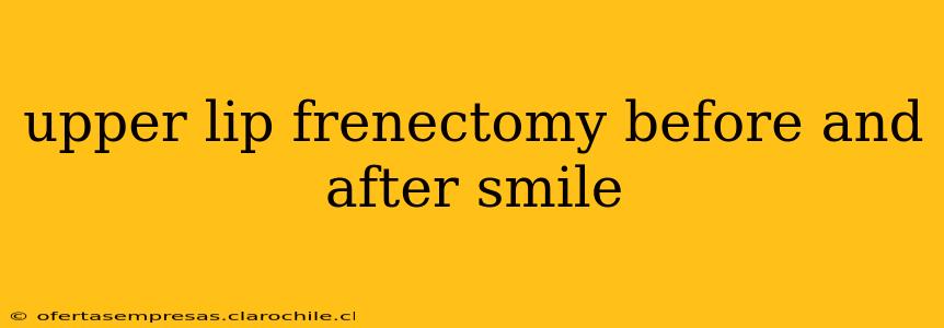 upper lip frenectomy before and after smile