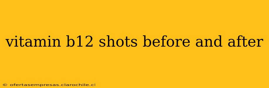 vitamin b12 shots before and after