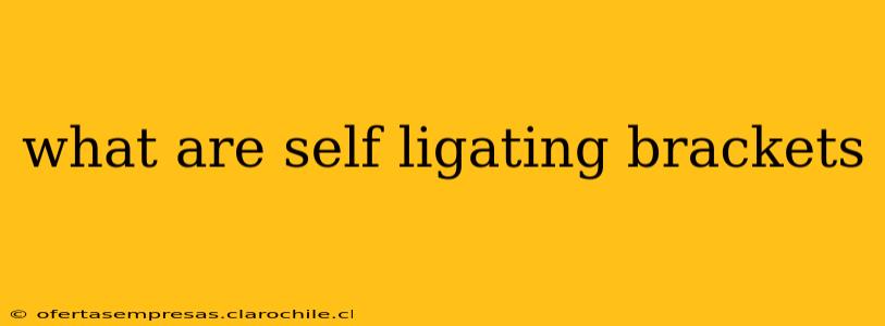 what are self ligating brackets