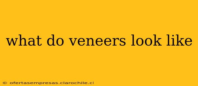 what do veneers look like