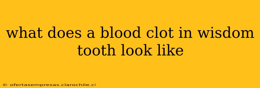 what does a blood clot in wisdom tooth look like