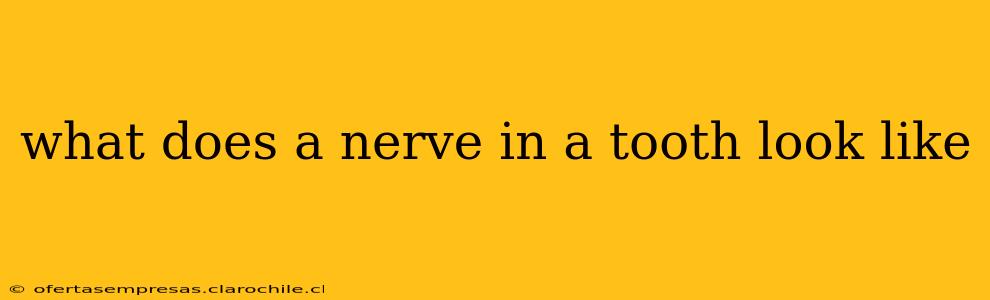 what does a nerve in a tooth look like