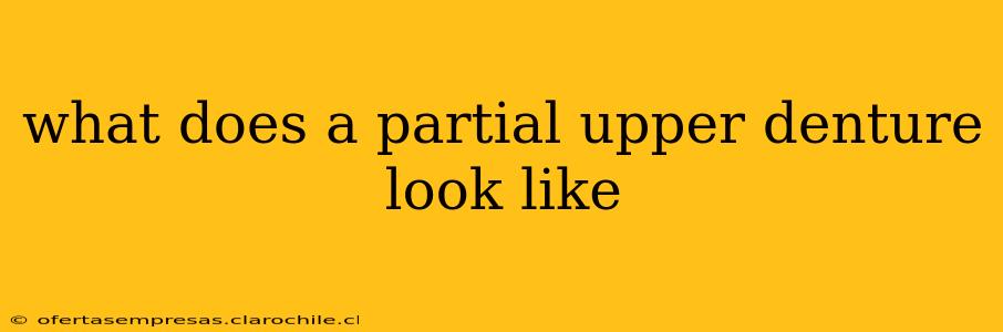 what does a partial upper denture look like