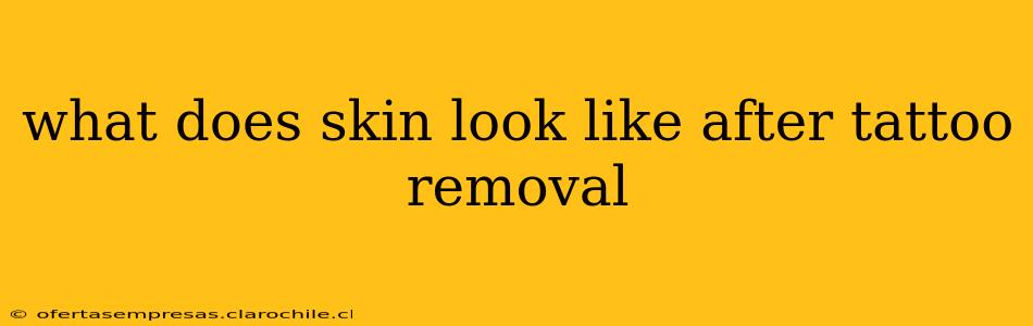 what does skin look like after tattoo removal