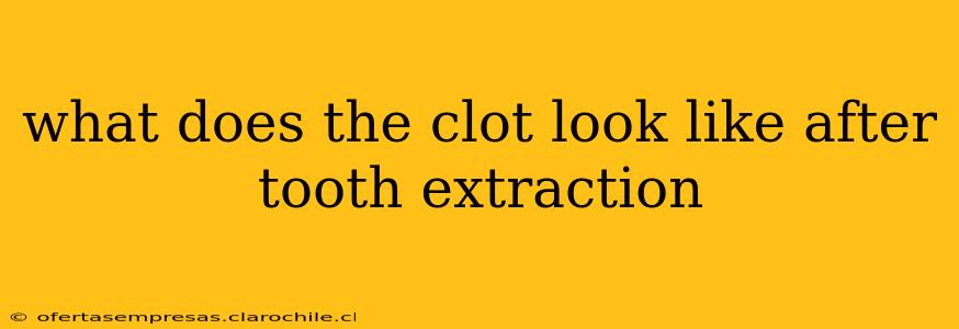 what does the clot look like after tooth extraction