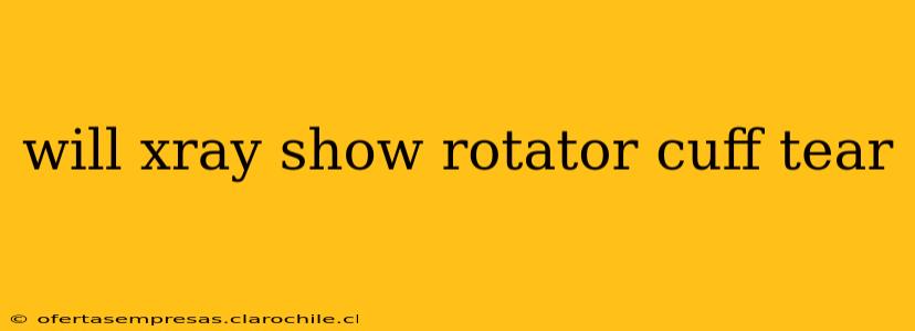will xray show rotator cuff tear