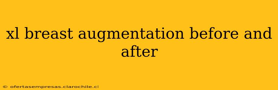 xl breast augmentation before and after